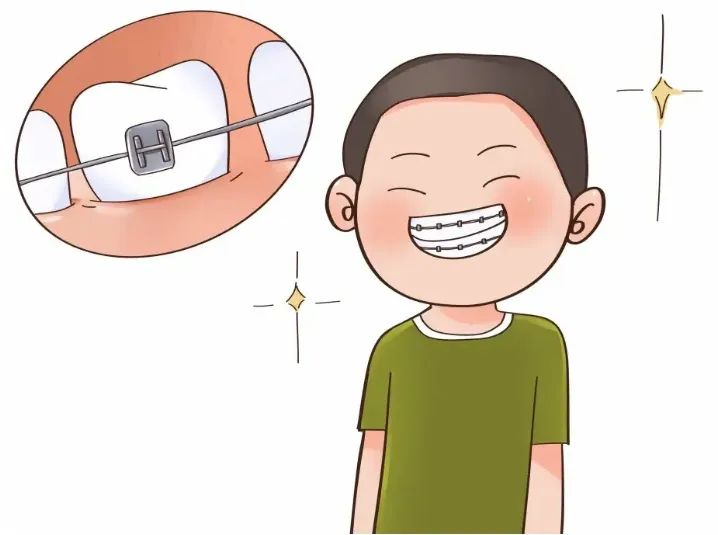 有效缩短矫正时长，不妨试试这些方法！