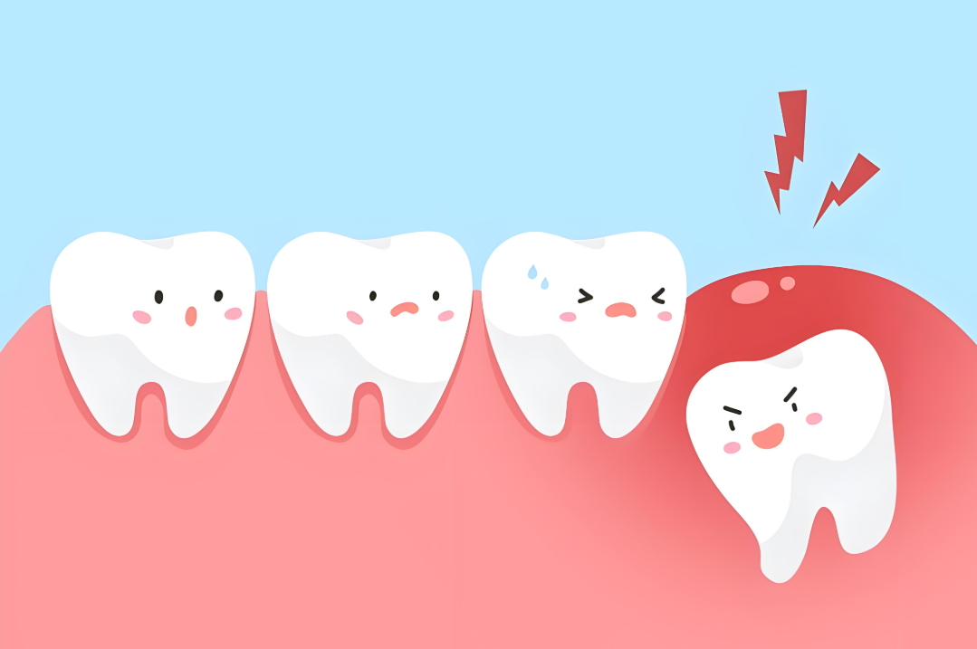 智齿一定要拔吗？这几点你一定要知道！建议收藏~