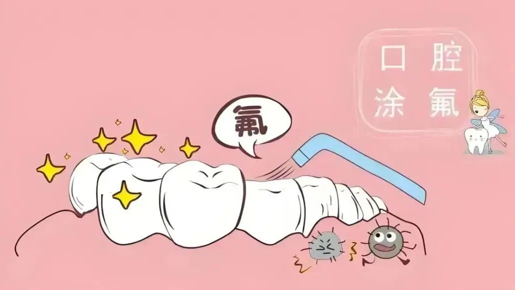 关于宝宝涂氟和窝沟封闭，这些小常识你了解吗？