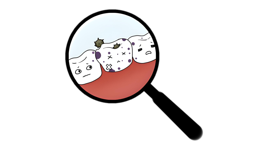 小朋友牙齿上小小黑点难刷净？可能不是蛀牙，而是......